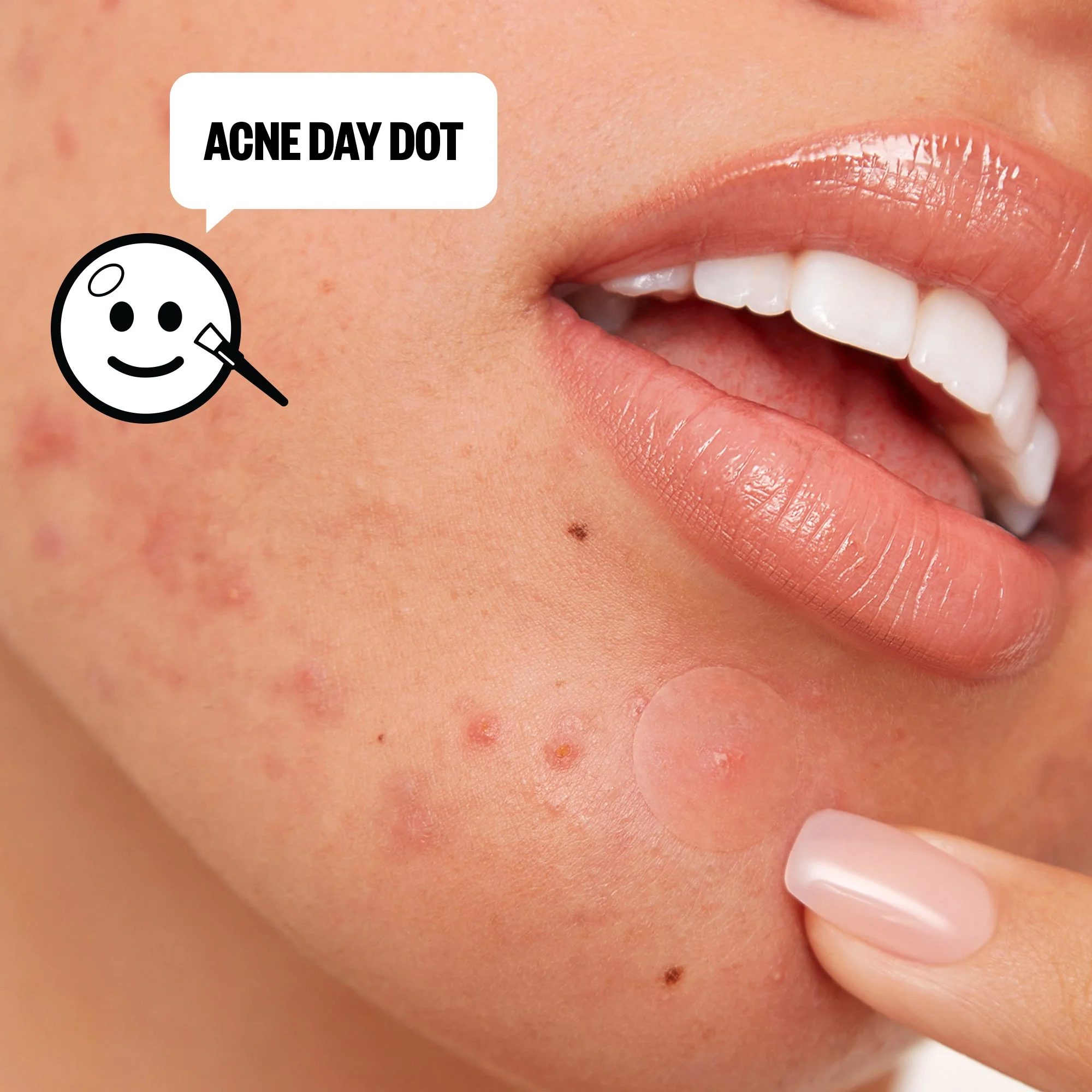 Acne Day & Night Duo (CAN) - Image 8