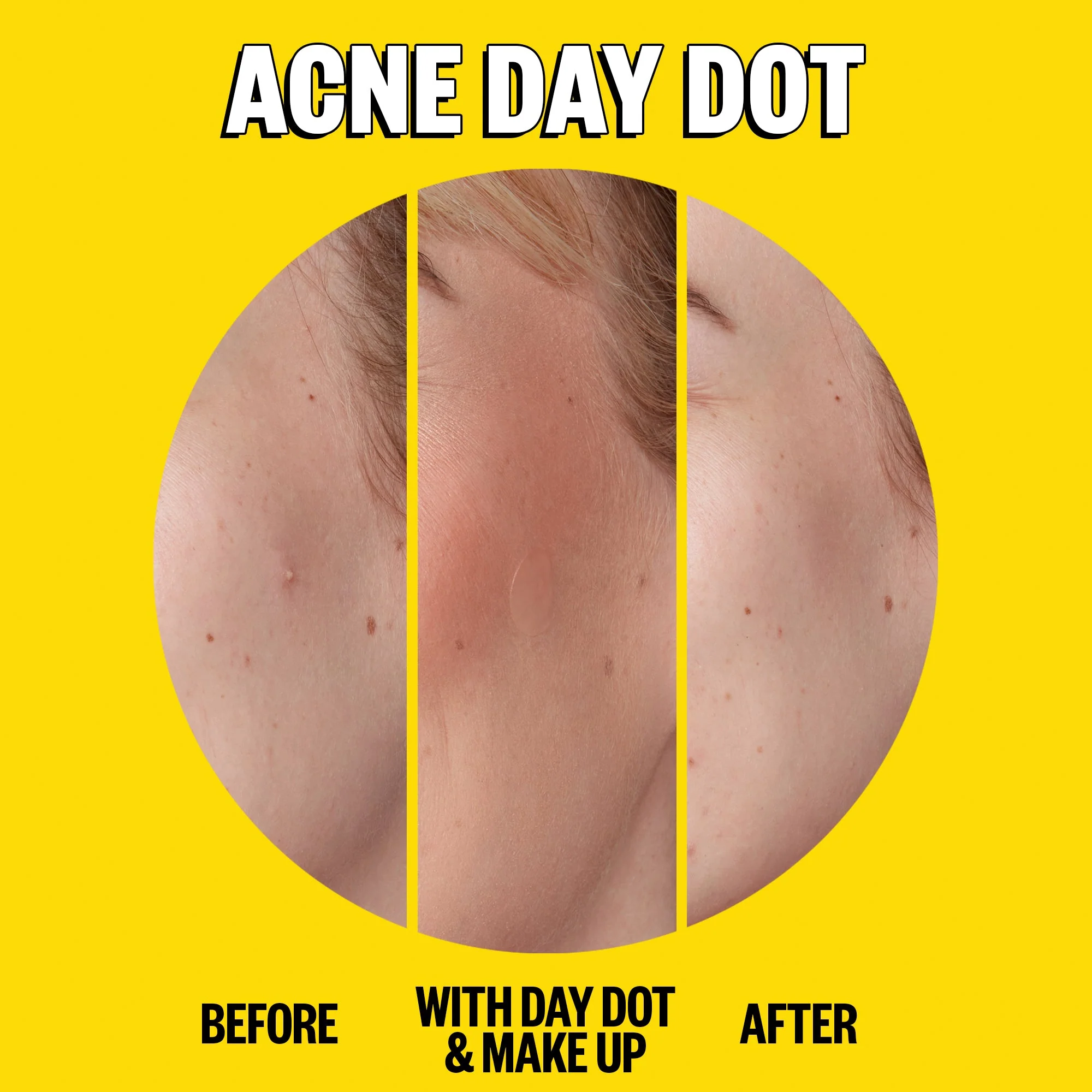 Acne Day & Night Duo (UNI) - Image 3