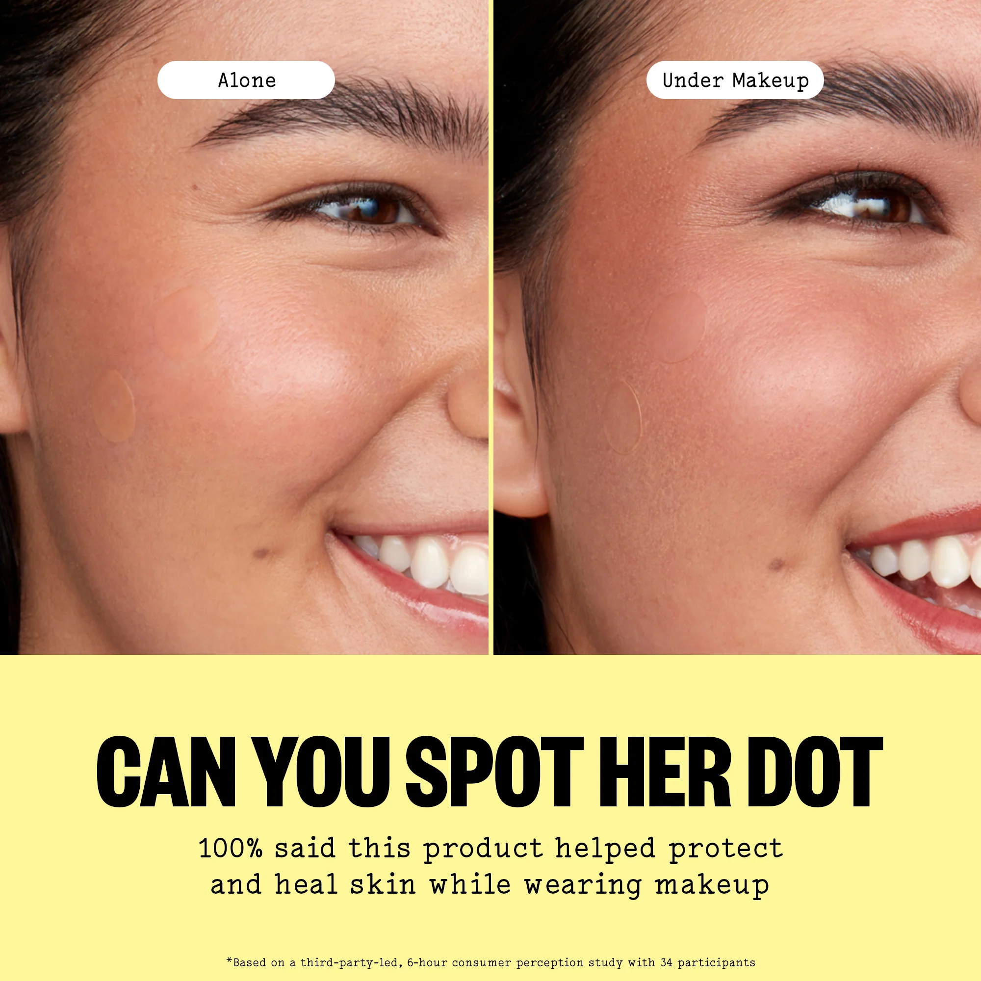 Acne Day & Night Duo - Image 6