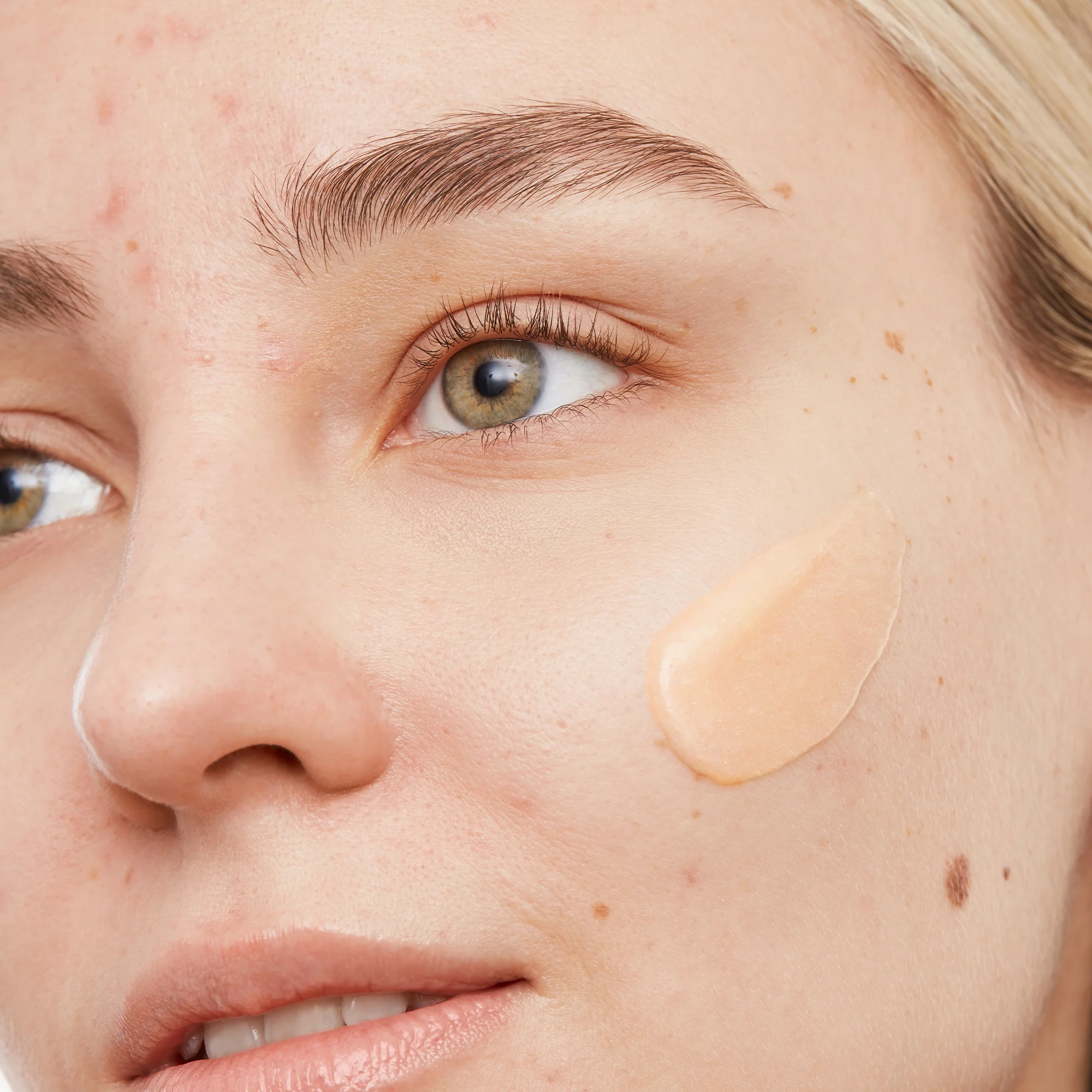 Acne Gel Cleanser (UNI) - Image 5