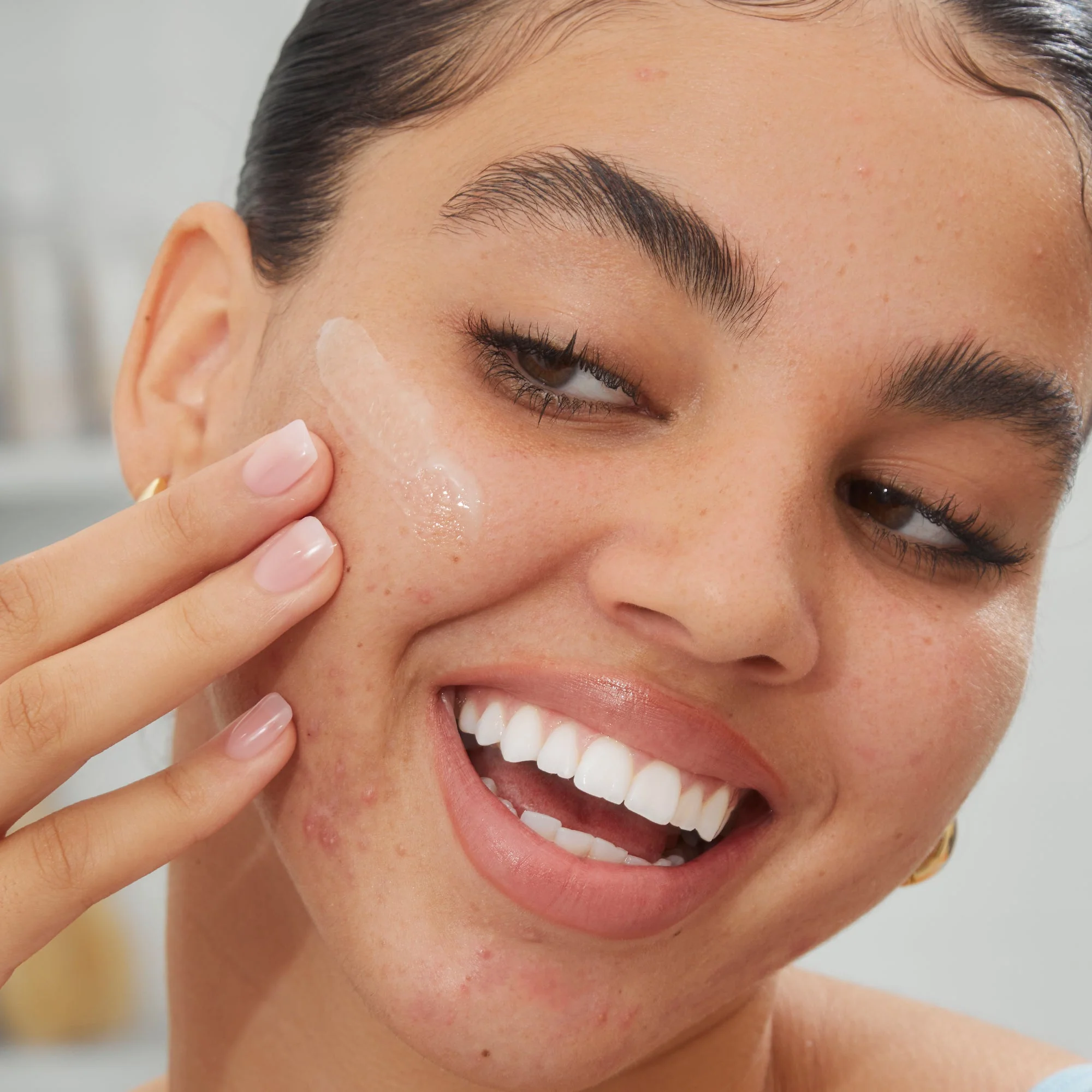 Acne Serum (UNI) - Image 8