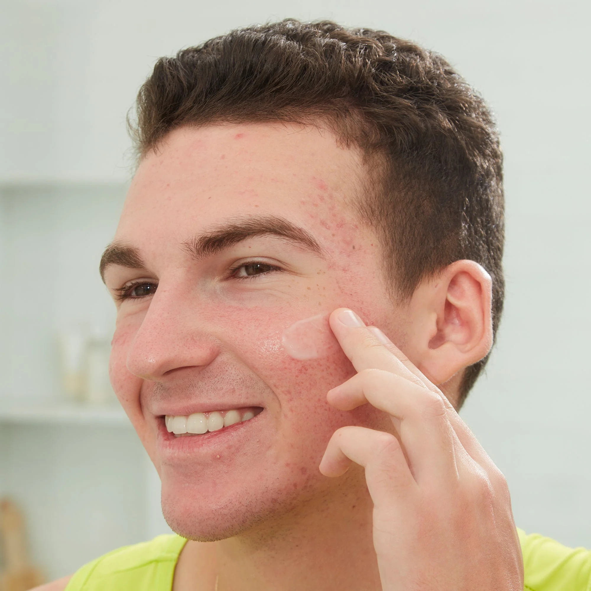 Acne Serum (UNI) - Image 9