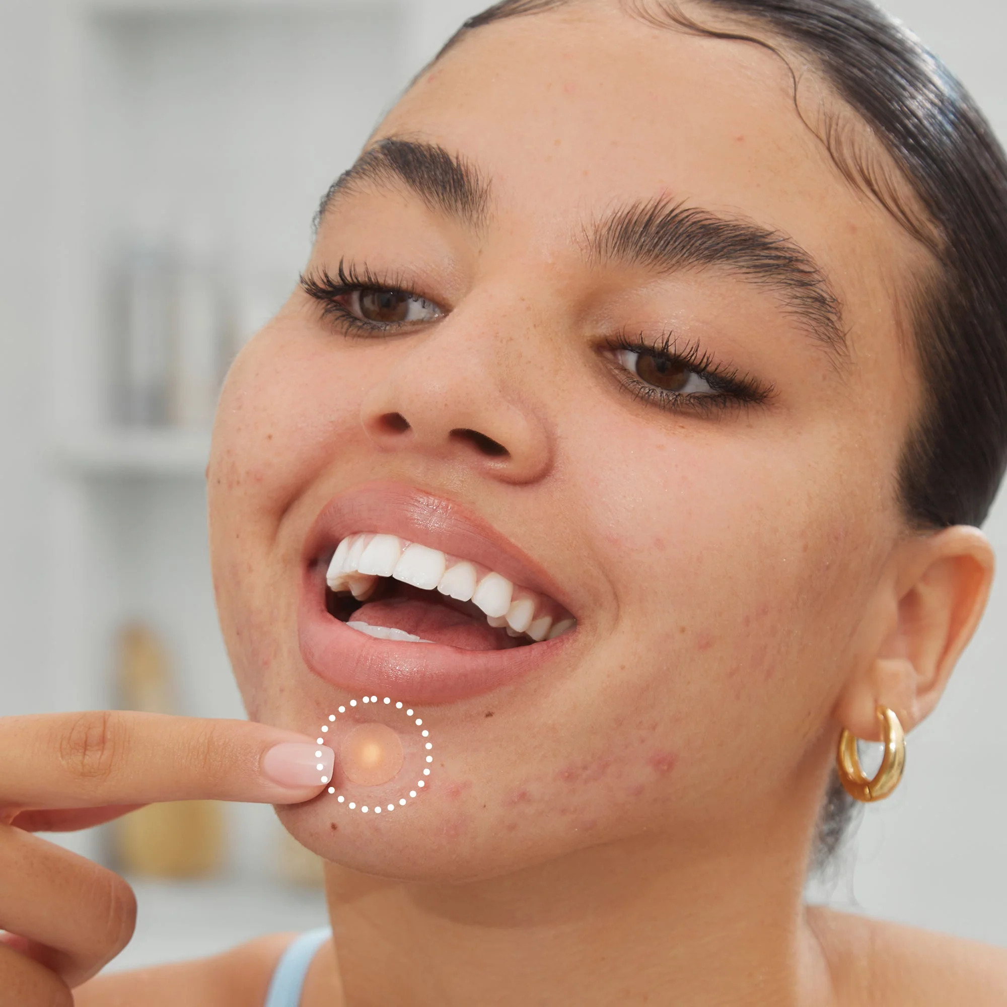 Acne Treatment Dots (CAN) - Image 10