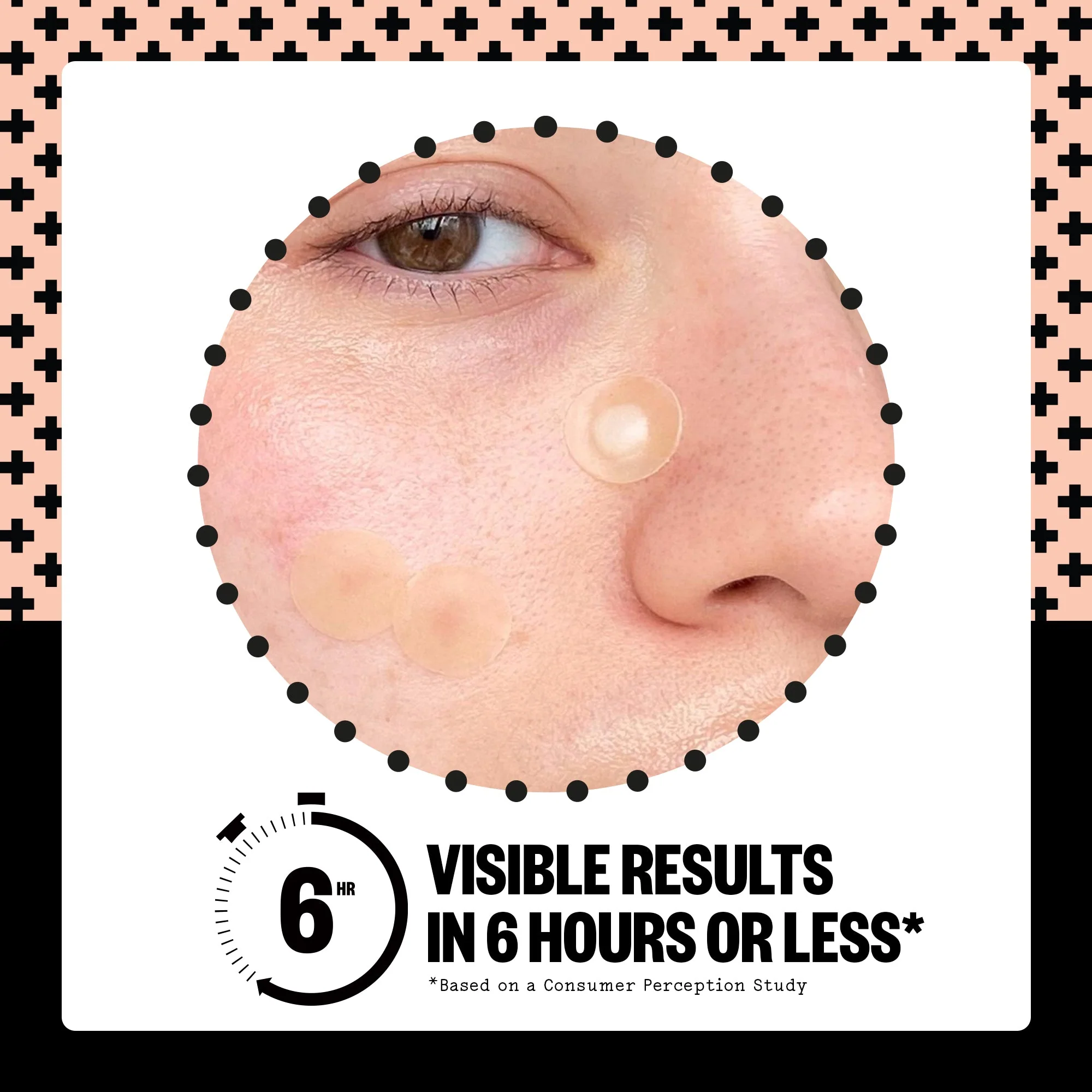 Acne Treatment Dots (CAN) - Image 14