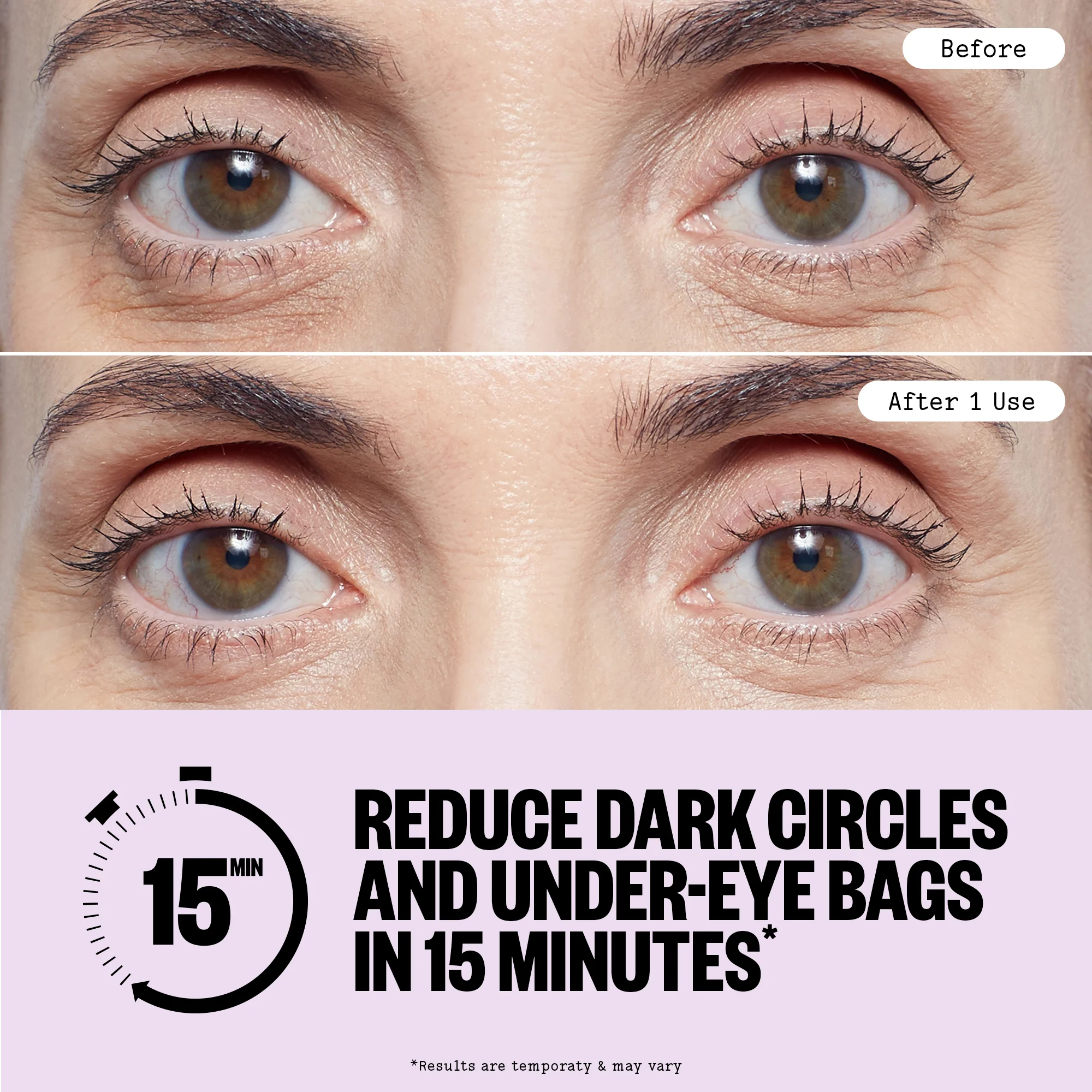 Puffy Eyes - Image 6
