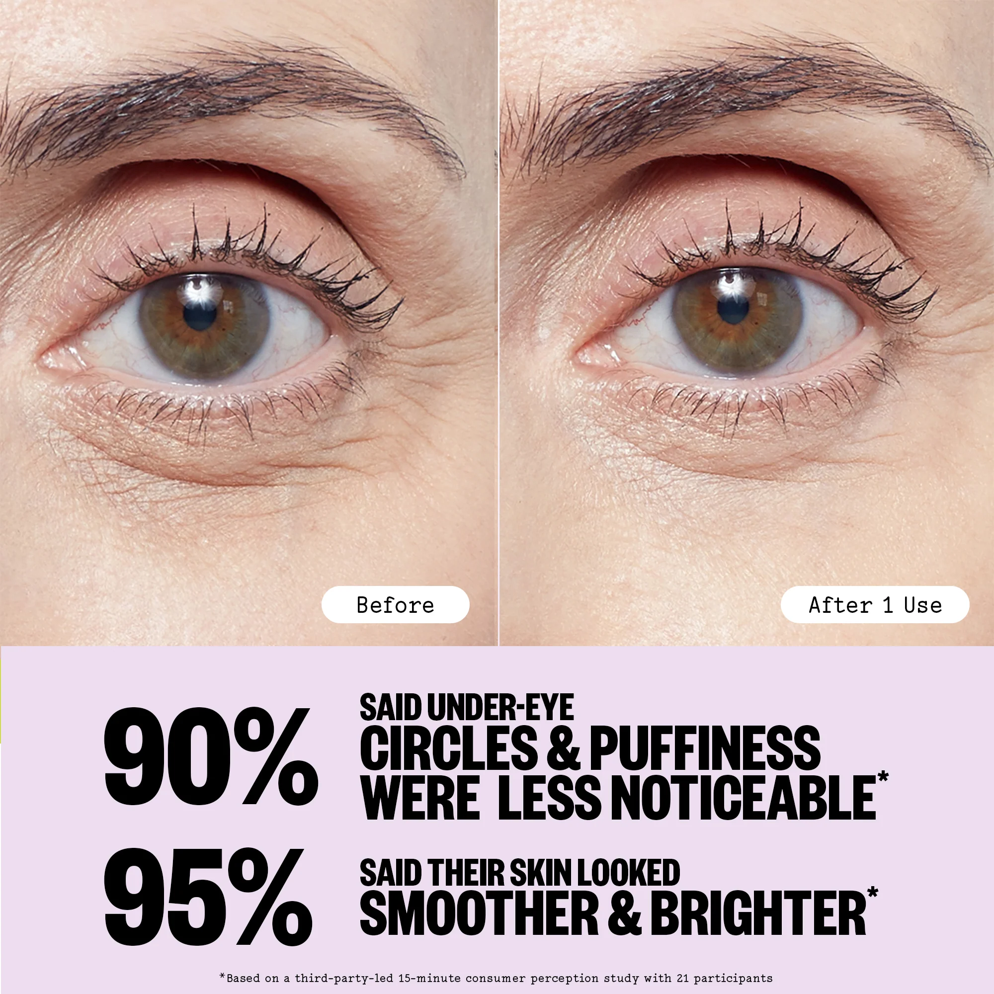 Puffy Eyes - Image 7