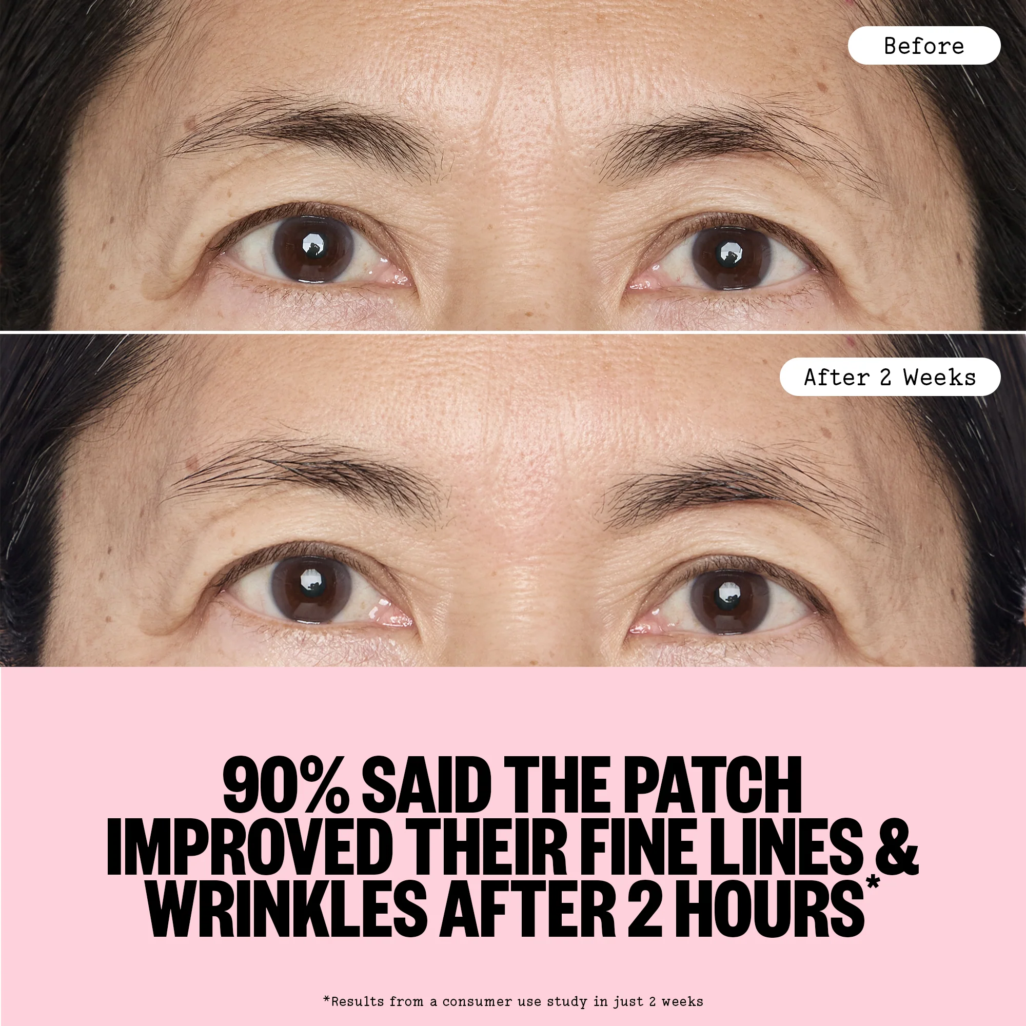 Peace Out Wrinkles - Image 6