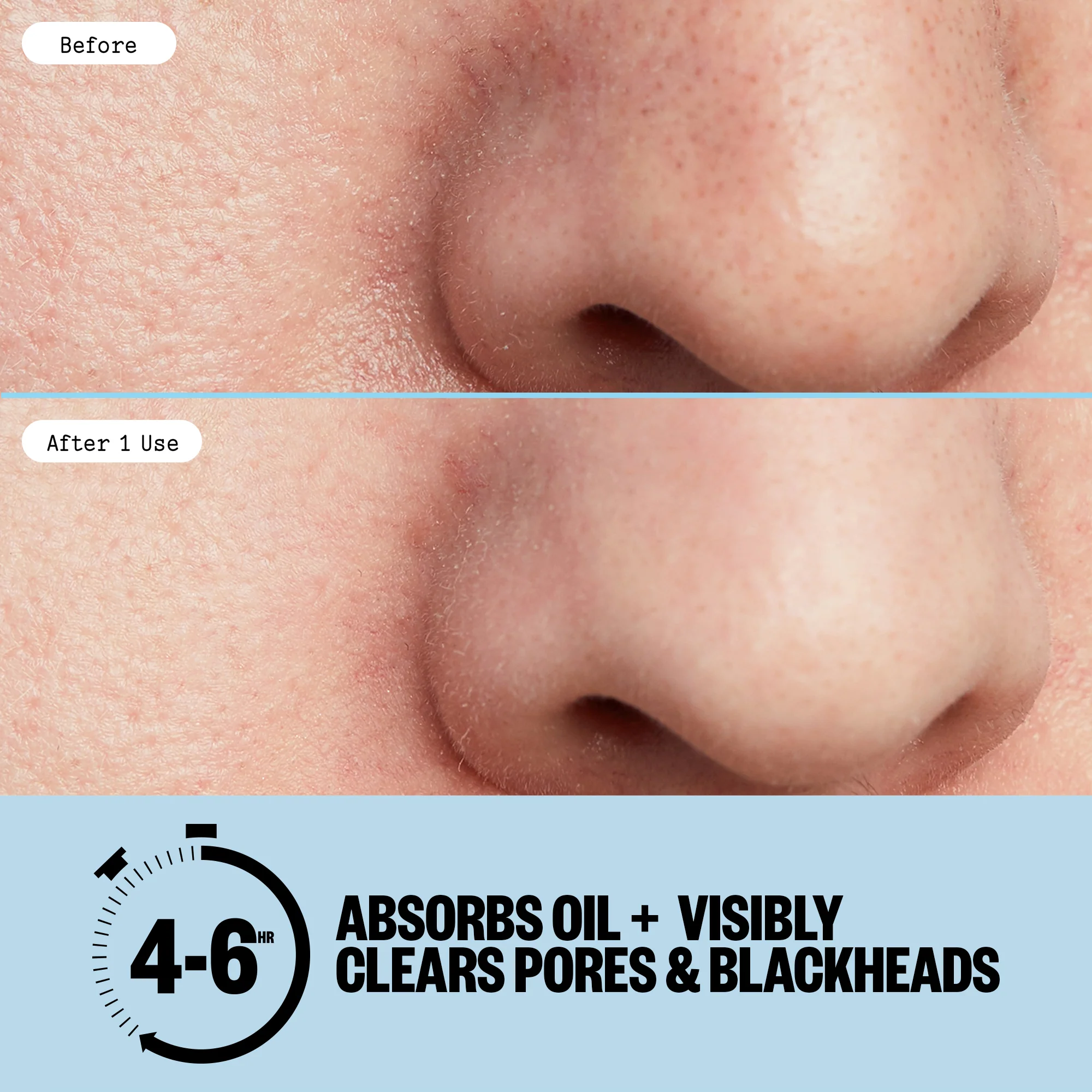 Pore Minimizing Strips - Image 7
