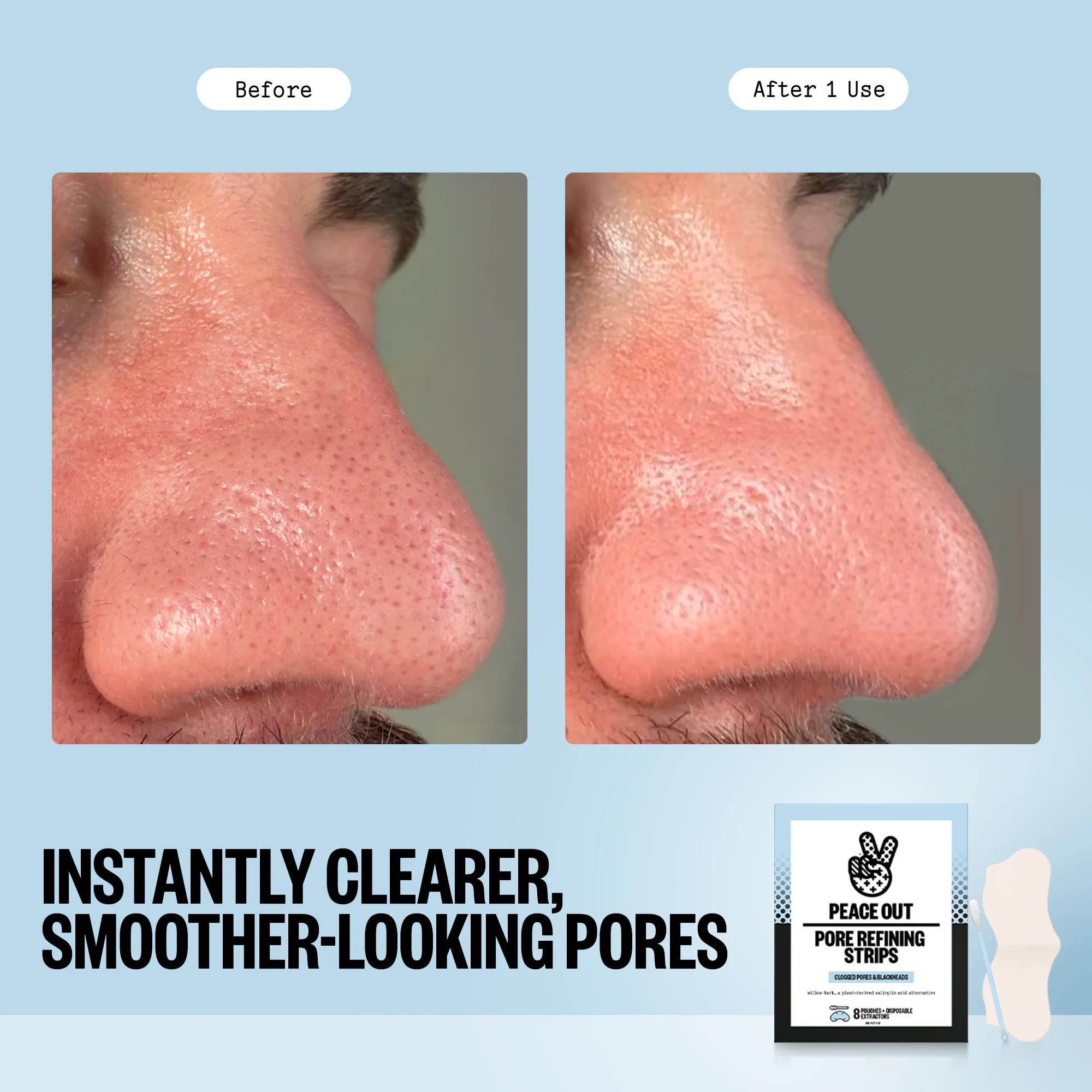 Pore Refining Strips - Image 3