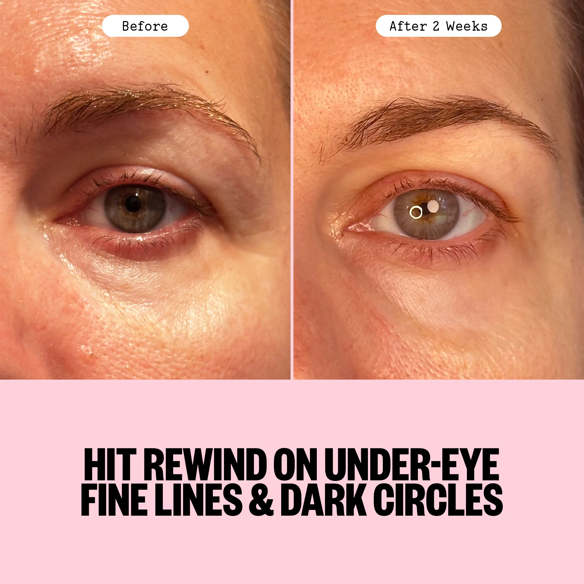 Retinol Eye Jelly Stick - Image 6