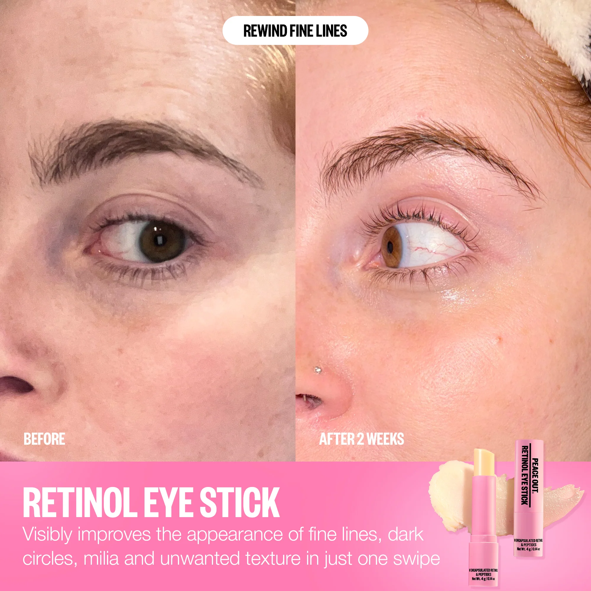 Retinol Eye Stick - Image 10